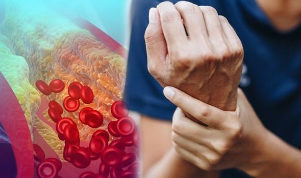 Top 4 Symptoms of High Cholesterol Problems