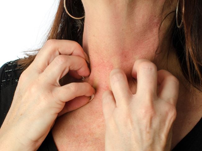 4 ways to get rid of skin allergy